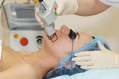 Types of laser rejuvenation of facial leather